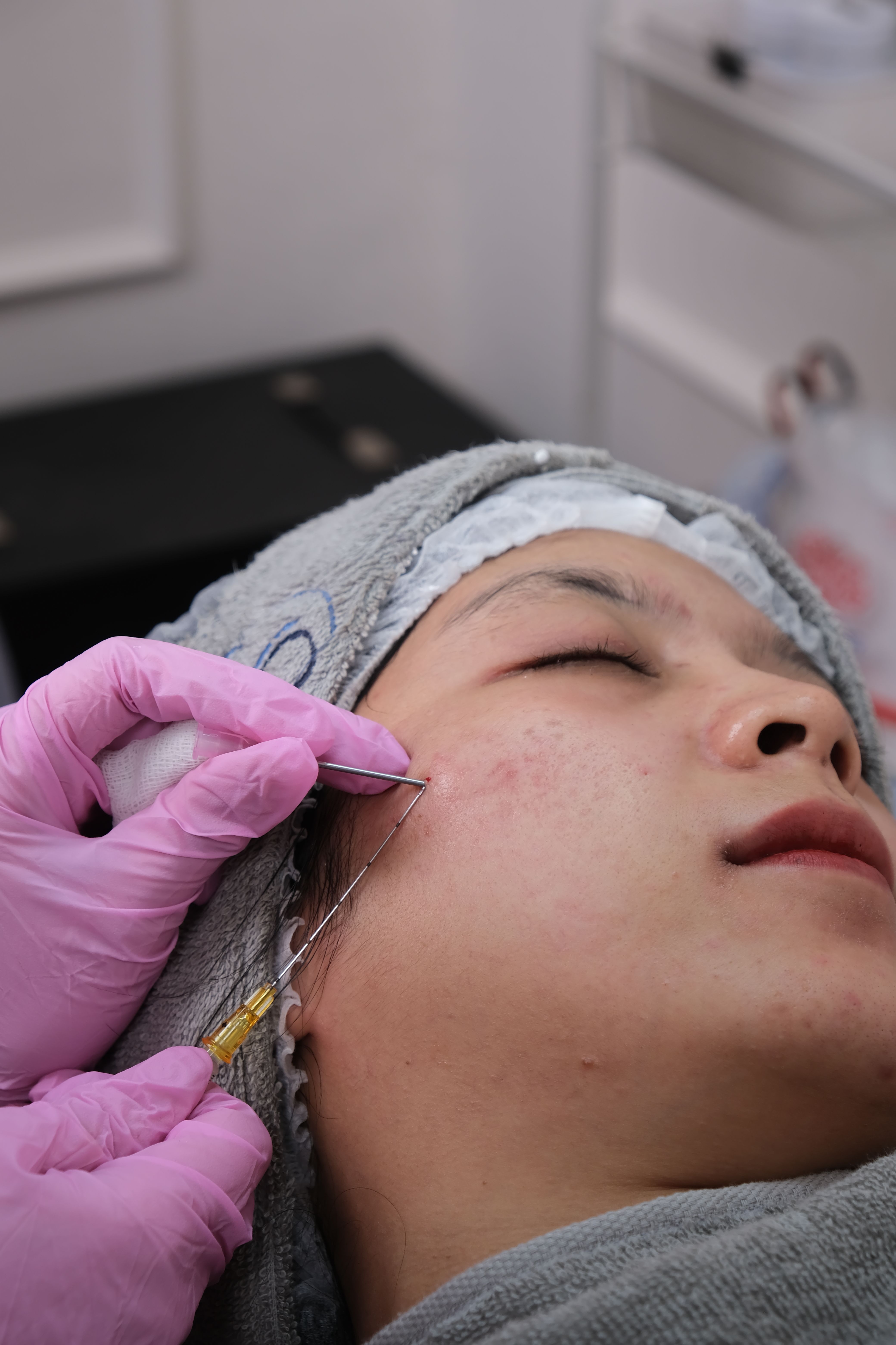 Facial treatment at Dr. Khatera Habib Wali clinic - Hair and skin care in Kabul
